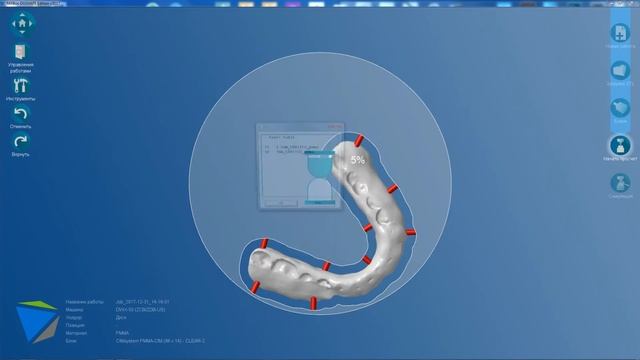 Millbox: calculation of splint / расчет стратегии фрезерования окклюзионной шины смотреть онлайн