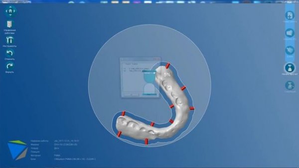 Millbox: calculation of splint / расчет стратегии фрезерования окклюзионной шины