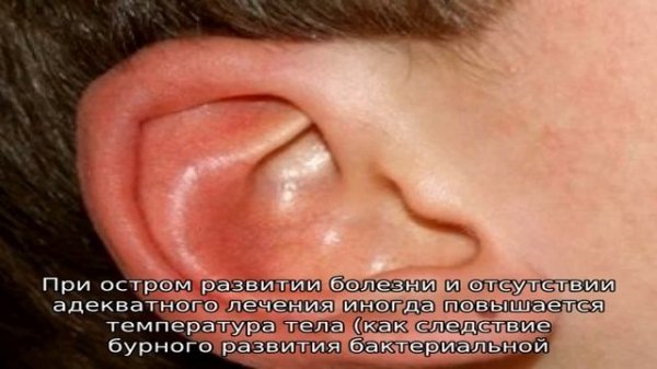Фурункул и чирей в ухе