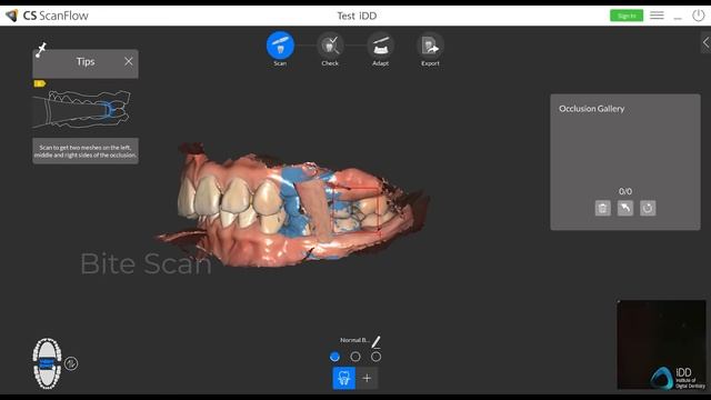 Carestream Dental CS 3700 Intraoral Scanner Review + CS ScanFlow смотреть онлайн