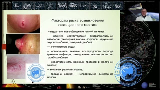 МАСТИТ МУСТАФИН ЧИНГИС смотреть онлайн