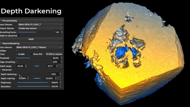 SlicerHeart: Echo Volume Rendering Module in 3D Slicer смотреть онлайн