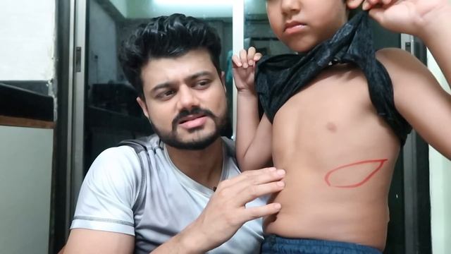 SPLEEN का SIZE बढ़ना ? WHAT IS SPLENIC RUPTURE смотреть онлайн