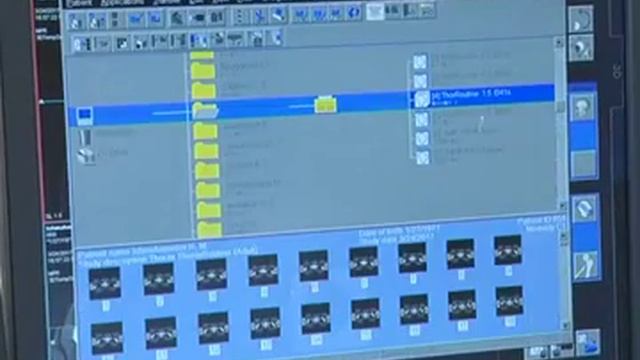 Открытие кабинета компьютерной томографии смотреть онлайн