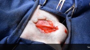 скротальная уретростомия