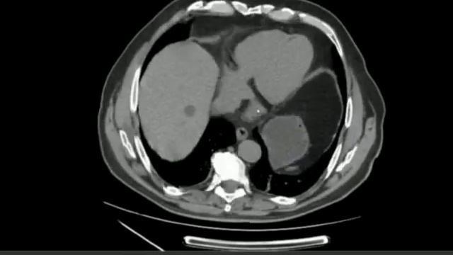 IMAGENES DICOM "DESCARGALAS GRATIS AQUI" смотреть онлайн