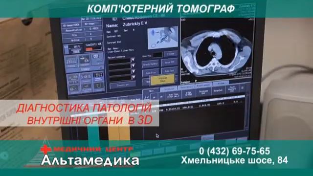 Компьютерная томография в медицинском центре "Альтамедика" смотреть онлайн