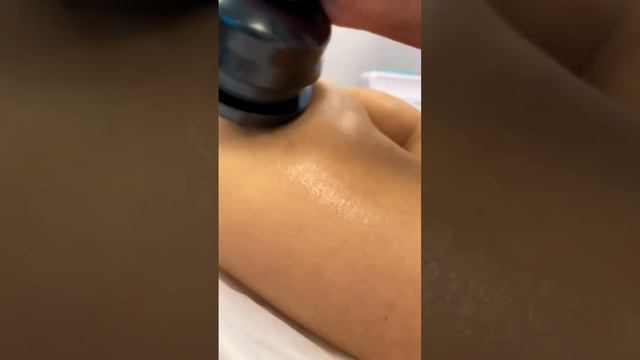 Рилс для студии Лазерной эпиляции