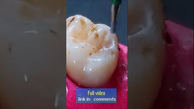 Bring back the beauty смотреть онлайн