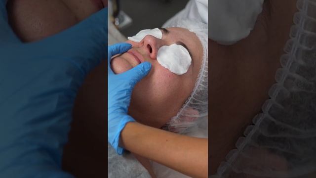 Как делается механическая чистка лица? 2 часть смотреть онлайн