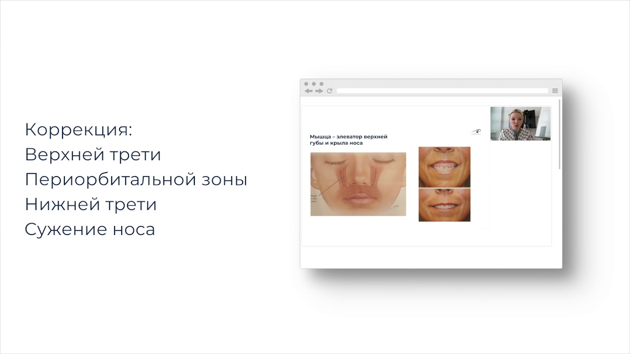 Нейротоксины. Взаимодействие ботулотоксинов и филлера смотреть онлайн