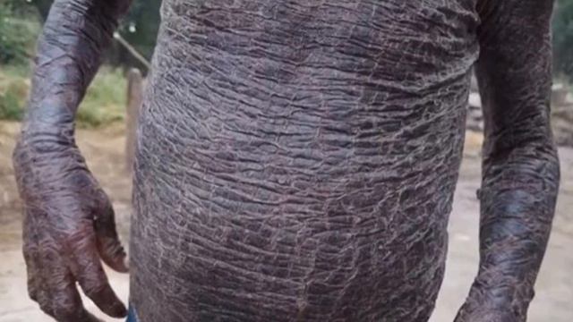 В ИНДИИ живет "МАЛЬЧИК-ЗМЕЯ" смотреть онлайн