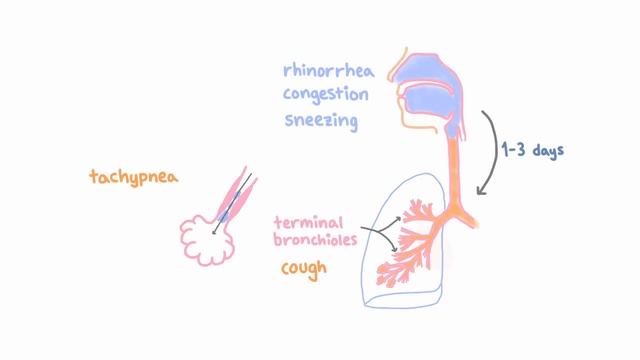 Respiratory Syncytial Virus (RSV) - Clinical Presentation