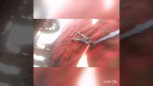 Opel Astra H gtc 1,8 демонтаж сальника рулевой рейки