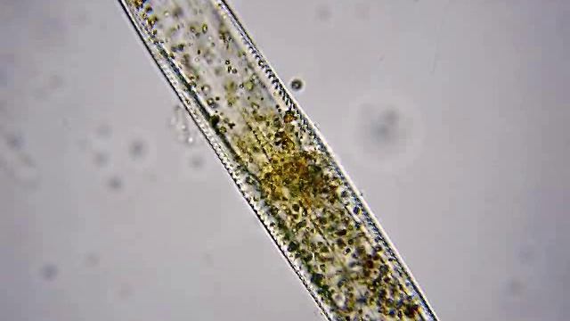 Микроскопия Диатомовые водоросли смотреть онлайн