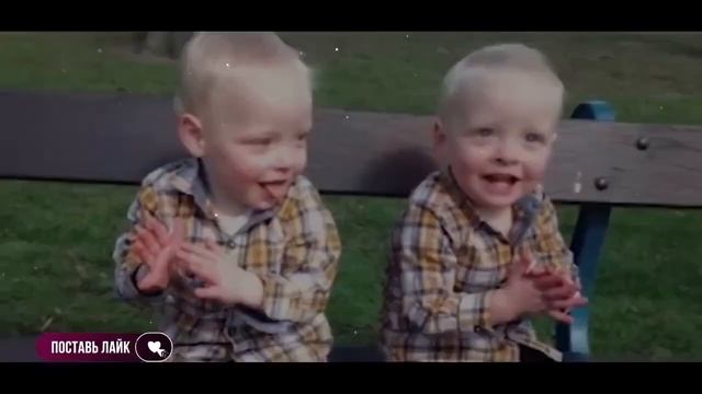 Редчайший случай! Врачи не знали что делать... Эти близнецы родились с удивительной особенностью!