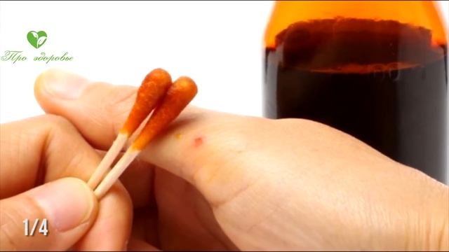 Вот как проверить щитовидку, не щупая горло: 4 домашних способа смотреть онлайн