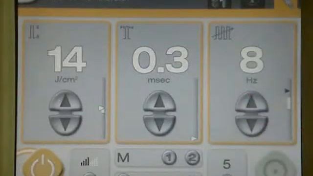 Cutera Touch Laser Genesis Display смотреть онлайн