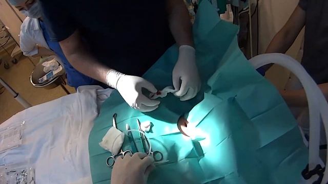 Трахеостома