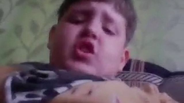 Сломал ребро ролики будут реже смотреть онлайн