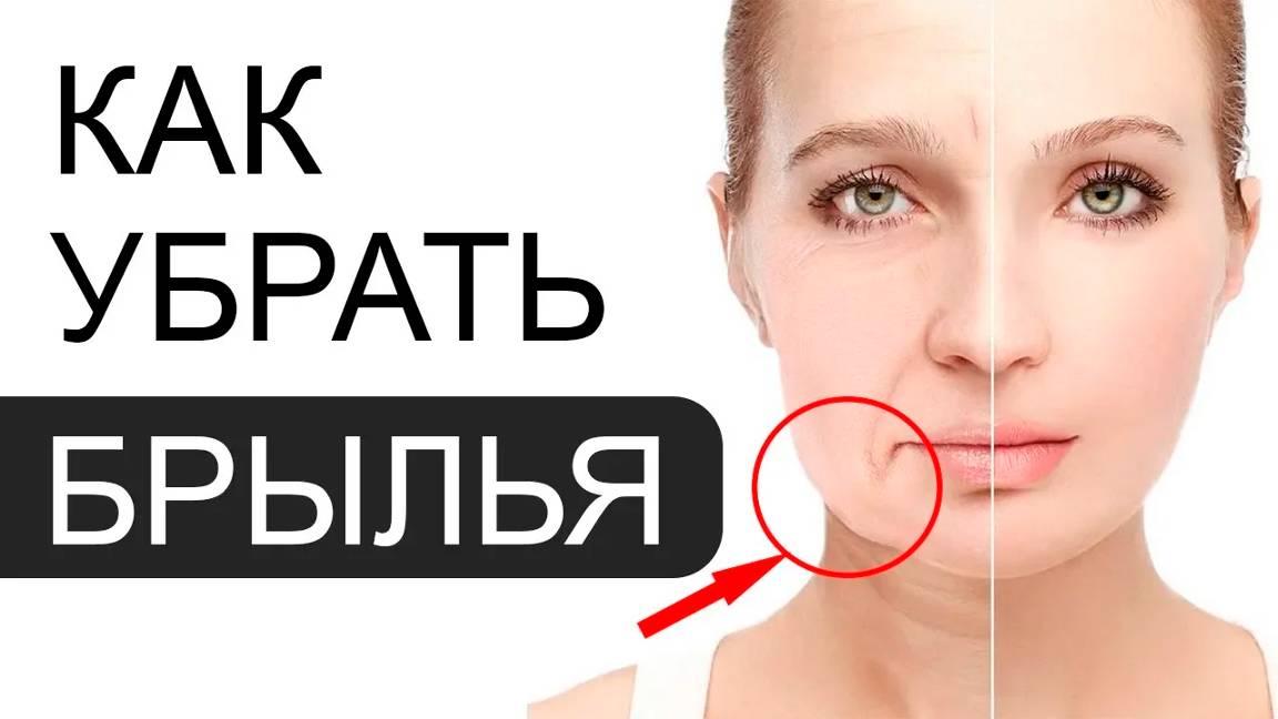 Как убрать БРЫЛЬЯ - обзор косметологических способов смотреть онлайн
