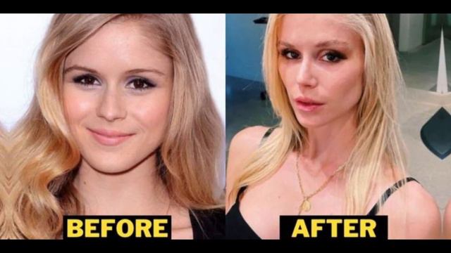 Actress Erin Moriarty Plastic Surgery Before And After смотреть онлайн