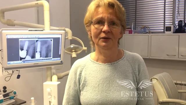 Имплантация Astra Tech и металлокерамические коронки