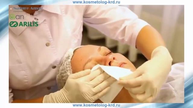 Гликолевый пилинг Краснодар. Пилинг гликолевой кислотой. смотреть онлайн