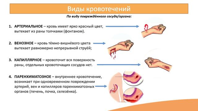 9.1. Кровотечения. Острое малокровие смотреть онлайн