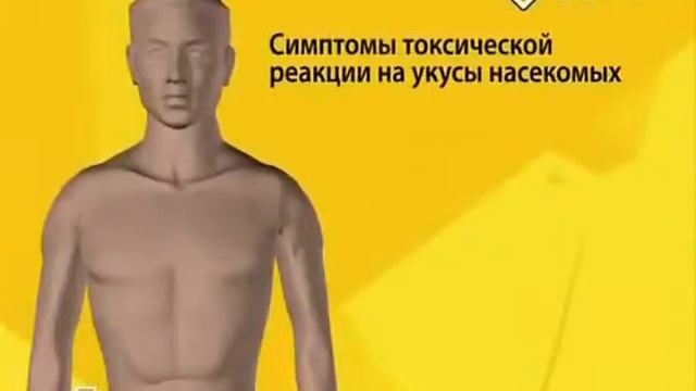 Укусы пчёл, ос, муравьев смотреть онлайн