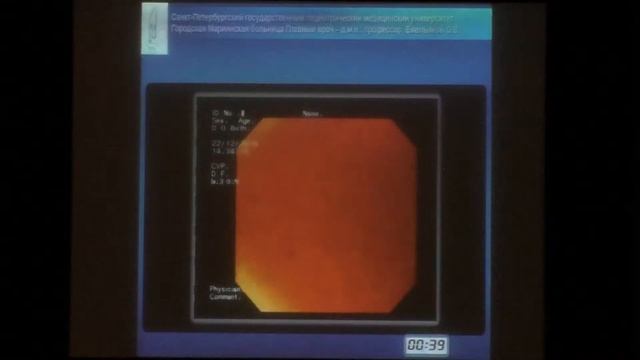 08 Федотов ЛЕ Осложнения при дивертикулах пищевода смотреть онлайн