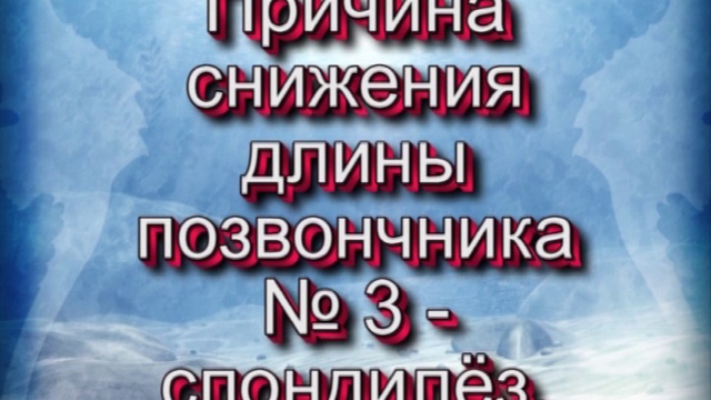 5. Межпозвоночные грыжи. Лечение смотреть онлайн