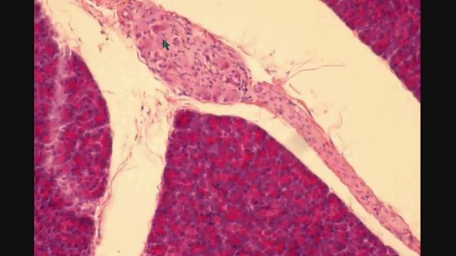 ПОДЖЕЛУДОЧНАЯ ЖЕЛЕЗА PANCREAS гистологическое строение смотреть онлайн