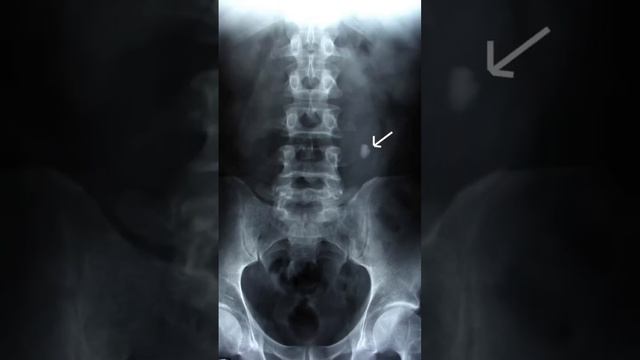 Боль в спине! Как понять где источник боли смотреть онлайн