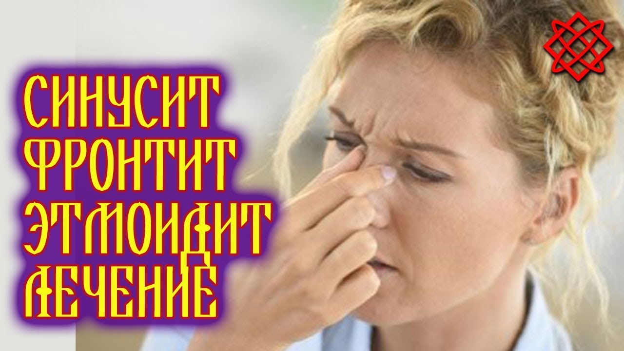 СИНУСИТ ФРОНТИТ ЭТМОИДИТ. Симптомы и Лечение Народными Средствами.mp4