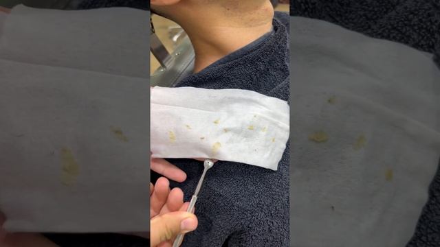 Yuz Uchun Maska #asmr #asmrbarber #asmrsounds #black #mask