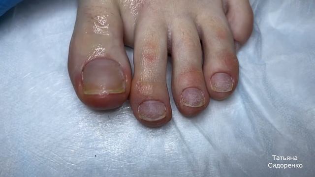 Желтые ногти ? Педикюр на клиенте / Как нарисовать Френч на ногах смотреть онлайн