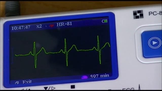 PC-80B ECG / md100 / md100E / md100B смотреть онлайн