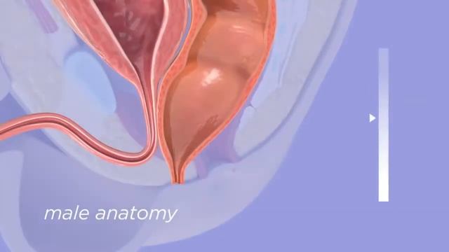Атрезия ануса. врождённый порок кишечника