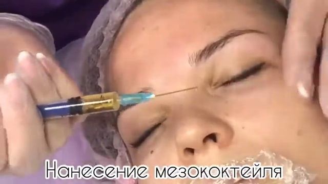 Фракционное омоложение - Салоны красоты "12 месяцев" смотреть онлайн