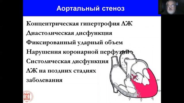 Соколов Аортальные пороки часть 1 смотреть онлайн