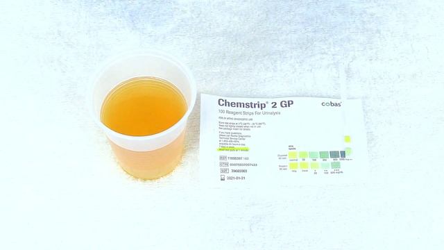 Pregnancy Urinalysis: Protein & Glucose in Urine Reagent Test Strips смотреть онлайн