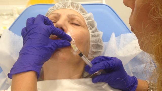 Аириском: студенты учатся; практика ученика, коррекция объема губ