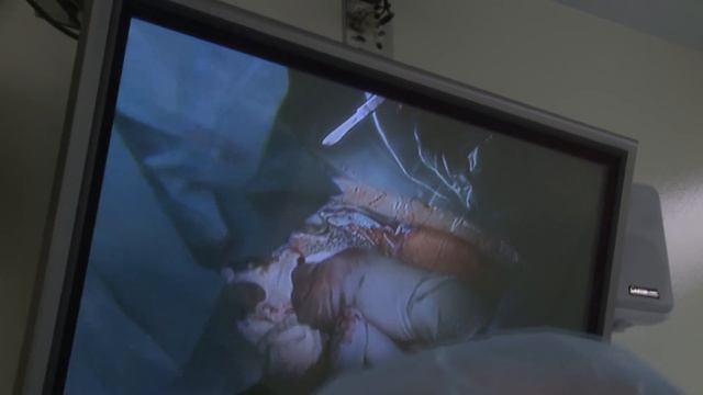 Naval Medical Center San Diego Performs First Ex-Utero Intrapartum Treatment Procedure смотреть онлайн
