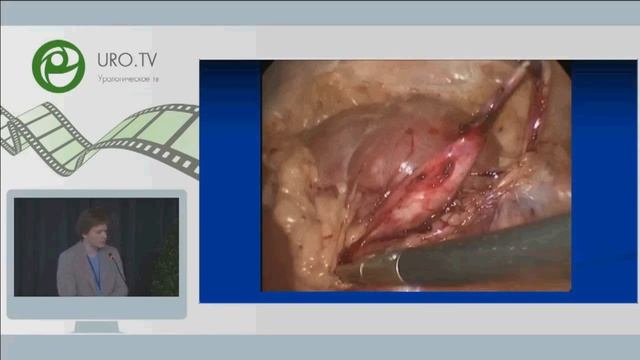 Гидронефроз. Лечение гидронефроза у детей. смотреть онлайн