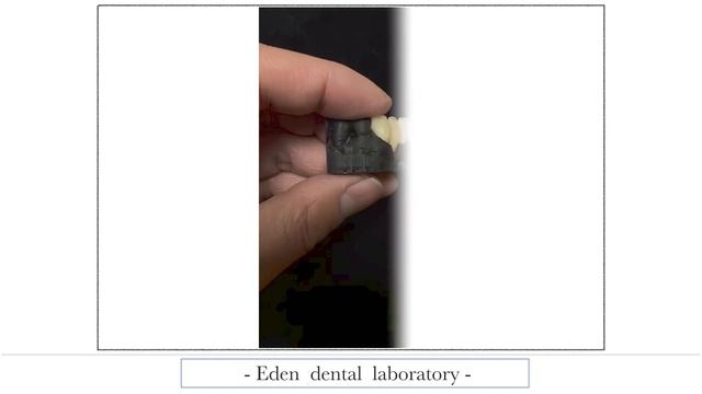 Oral scan case смотреть онлайн