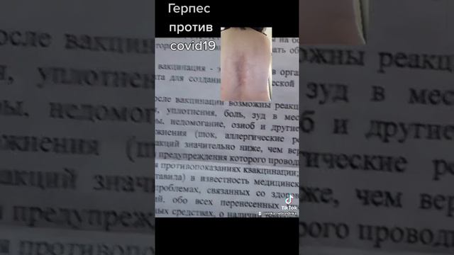 Вирус герпеса против covid19 смотреть онлайн