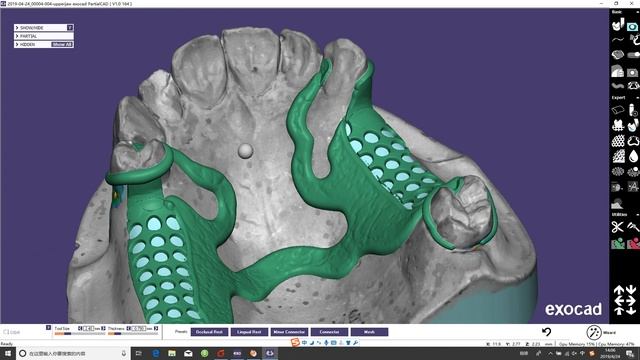 exocad partial framework design demo from Shining 3D смотреть онлайн