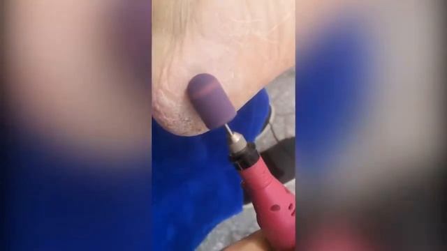 Bng grit 80 5pcs thermo abrasive cap sanding block caps with mandrel nail art for pedicure electric смотреть онлайн