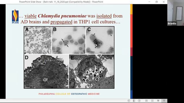 Dr. Brian Balin: The Pathogen Hypothesis of Late-Onset Alzheimer's смотреть онлайн